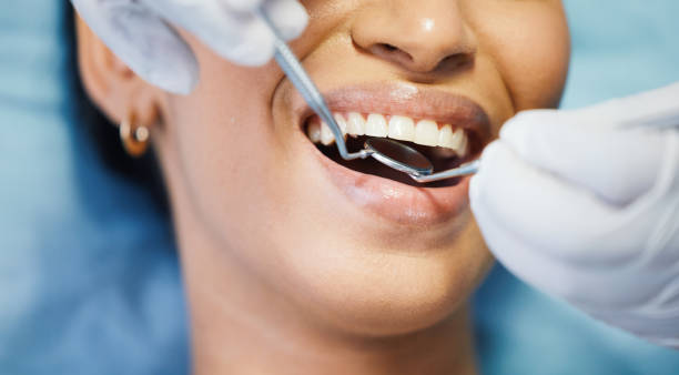 Best Teeth Whitening  in Peach Springs, AZ